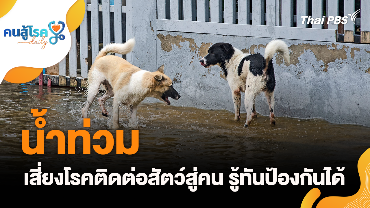 น้ำท่วมเสี่ยงโรคติดต่อสัตว์สู่คน รู้ทันป้องกันได้, “ผงชูรส” ทำให้หัวล้าน?