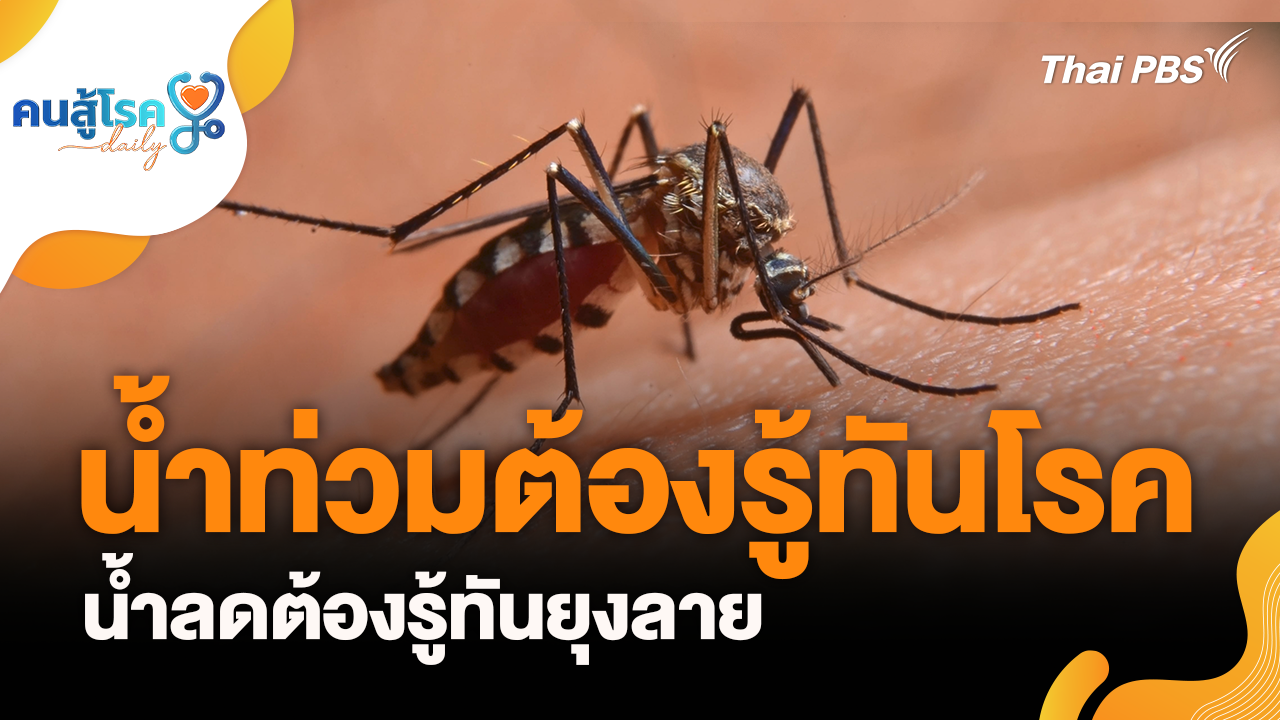 น้ำท่วมต้องรู้ทันโรค น้ำลดต้องรู้ทันยุงลาย